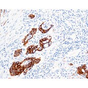 Cytokeratin 19 (CK19)